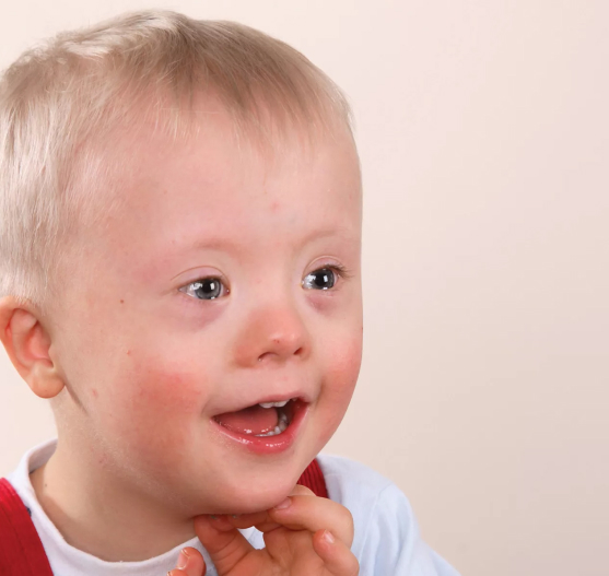 Олигофрения в Балабаново